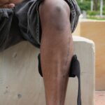 Hospital issues apology after urgent surgery patient was mistakenly discharged.