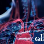 Researchers create innovative AI tool to identify heart failure risks up to five years in advance.