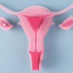 Study by Cama Reveals Urban Couples Postpone Infertility Treatments, Highlighting Ovulatory Disorders as a Major Factor