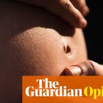 What led to a Florida woman’s unexpected C-section? | Tayo Bero