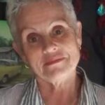 Family of woman ignited by son endures an unending ordeal