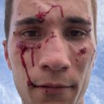 Individual Accused of Assaulting Law Enforcement Officer Released on Bail