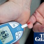 Study Predicts Nearly 2 Billion Individuals Will Face Metabolic Liver Disease by 2050