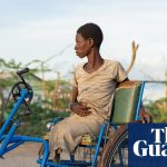 “Rising Waters of Lake Turkana: A Harrowing Toll of Crocodile Attacks on Lives and Limbs in Kenya”